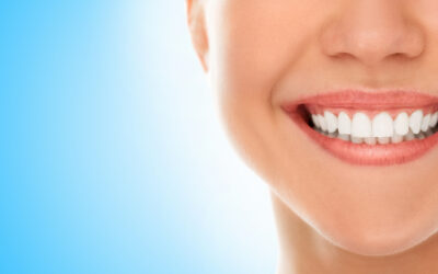 Maintaining Your Smile: The Importance of Dental Cleanings at Henley Dental